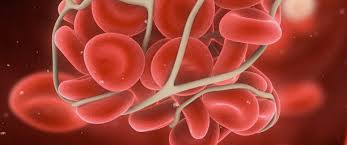 Hemophilia