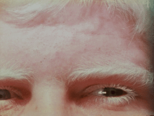 Vibrating Eyes