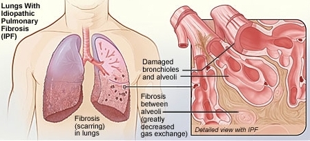 Diagram of PF